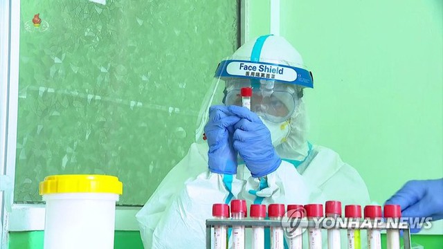 Gần 3 triệu ca “sốt”, Triều Tiên tuyên bố kiểm soát dịch - Ảnh 1.
