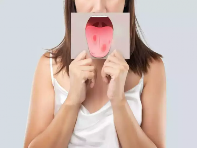 Dấu hiệu này trên miệng cảnh báo thiếu hụt vitamin và các bệnh khác - Ảnh 7.