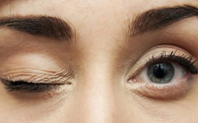 Nhiều người làm động tác này để giảm mỏi mắt mà không biết có thể gây biến dạng nhãn cầu