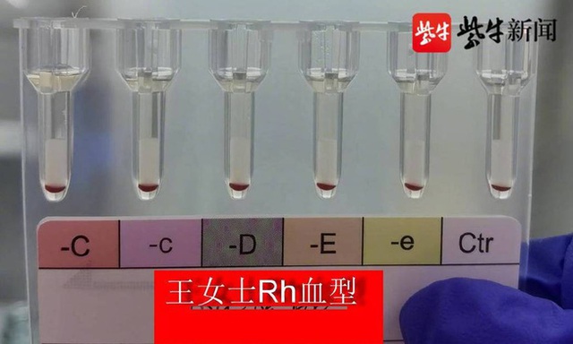 Phát hiện 2 người có nhóm ‘máu vàng’ hiếm nhất trên thế giới tại Trung Quốc - Ảnh 1.