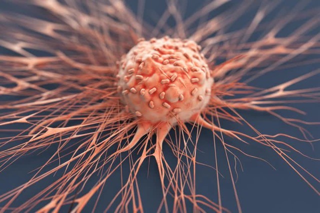 Có thể có tế bào tiền ung thư nhưng không phải ai cũng mắc bệnh: Làm tốt 5 việc, ung thư sẽ phải sợ bạn - Ảnh 3.