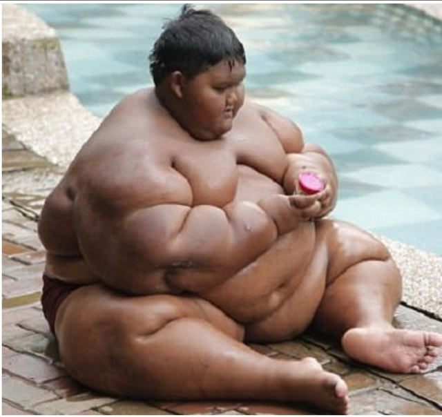 Từng nặng gần 200kg khi mới 10 tuổi, cậu bé “béo nhất thế giới” bây giờ ra sao sau hành trình giảm cân không tưởng? - Ảnh 4.