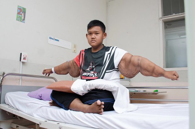 Từng nặng gần 200kg khi mới 10 tuổi, cậu bé “béo nhất thế giới” bây giờ ra sao sau hành trình giảm cân không tưởng? - Ảnh 9.
