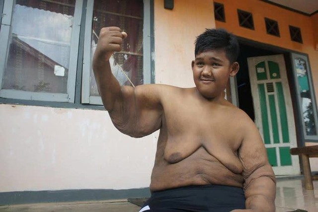 Từng nặng gần 200kg khi mới 10 tuổi, cậu bé “béo nhất thế giới” bây giờ ra sao sau hành trình giảm cân không tưởng? - Ảnh 8.