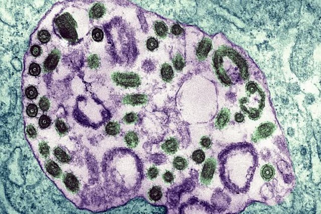  Đã có 9 người chết liên quan đến virus Marburg: Các chuyên gia nói gì về dịch bệnh với tỷ lệ tử vong lên tới 88%?  - Ảnh 3.