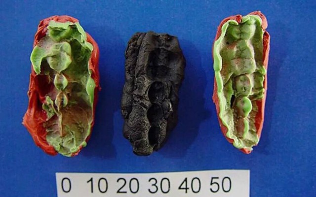Những mẩu "kẹo cao su" 10.000 năm tuổi được tìm thấy ở Thụy Điển. Ảnh: ATI