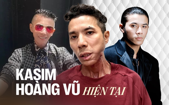 Chuyện gì đã xảy ra với Kasim Hoàng Vũ?