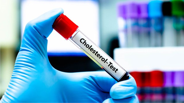 Mỡ máu cao vút bất ngờ hạ về mức bình thường: Bác sĩ thốt lên "5 thói quen này rất đáng học hỏi”