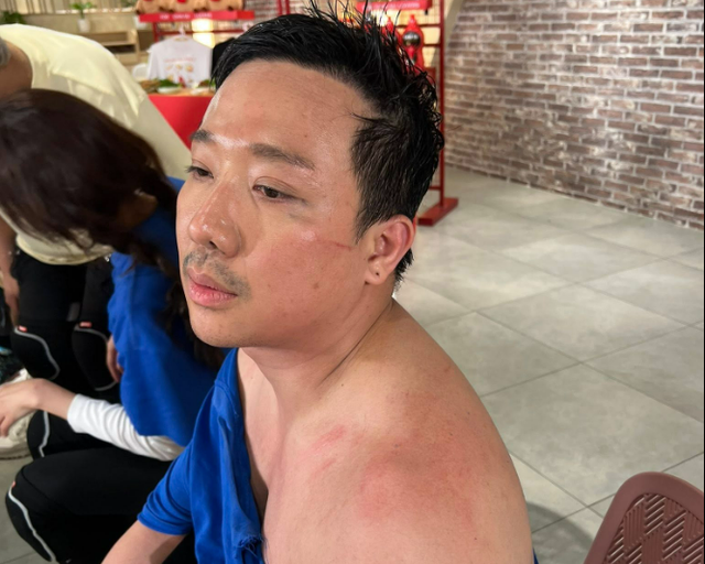 Trấn Thành tiếp tục phải trả giá