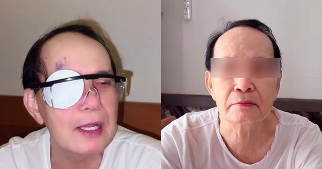 Nam NSND 81 tuổi phải phẫu thuật lần hai: "Hết rồi!"