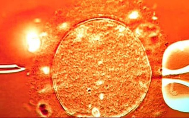 67 trẻ sinh ra từ tinh trùng người hiến mang gene ung thư, 10 trẻ mắc bệnh 67 trẻ sinh ra từ tinh trùng người hiến mang gene ung thư, 10 trẻ mắc bệnh