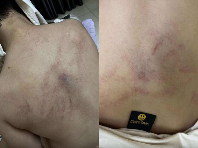 Nóng: Bé gái 4 tuổi bị cô giáo mầm non công lập ở Hà Nội bạo hành dã man, trích xuất camera phát hiện hành động gây sốc