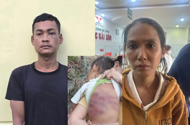 Bắt khẩn cấp đôi nhân tình hành hạ dã man bé trai 2 tuổi gây phẫn nộ dư luận ở TP.HCM