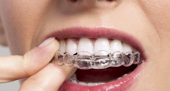Dùng kem đánh răng hàng ngày mà răng vẫn vàng ố, nghe nha sĩ Mỹ chia sẻ 3 cách làm trắng răng tức thì
