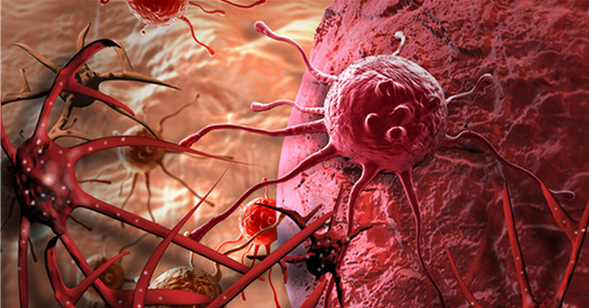 Ai cũng có tế bào ung thư trong cơ thể: 3 nguyên tắc vàng chặn đứng sự hình thành khối u