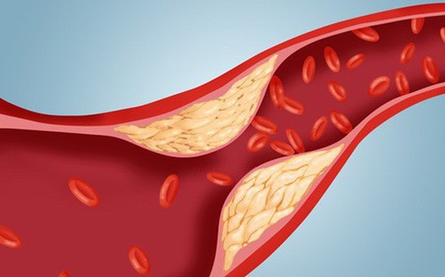 Chanh và tỏi cũng giúp làm sạch mạch máu, giảm mỡ máu