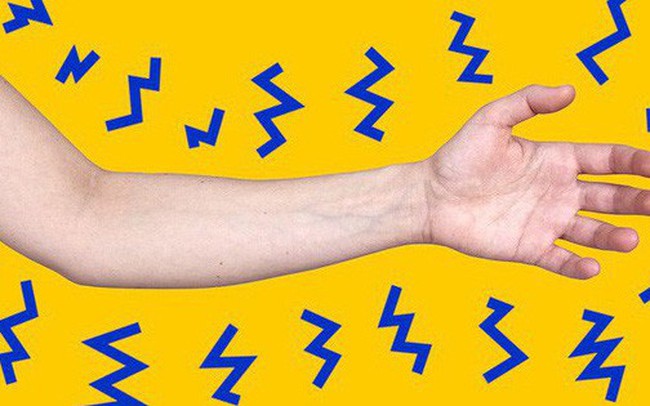 Tê tay như bị kim châm khi ngủ dậy, nguyên nhân là gì và khi nào thì nguy hiểm?
