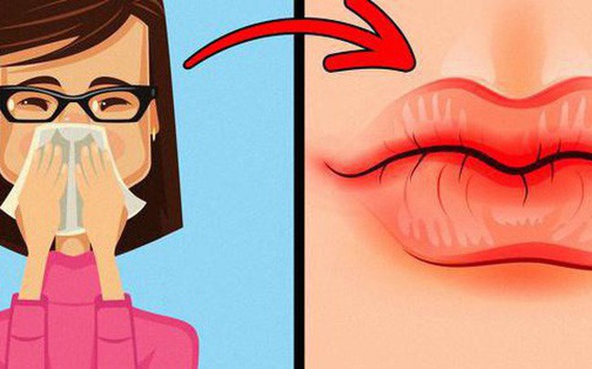 8 dấu hiệu của đôi môi cần đặc biệt chú ý vì sức khoẻ của bạn đang gặp vấn đề