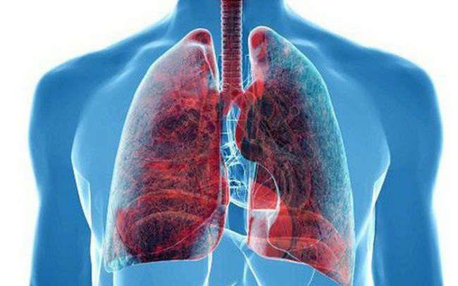 Bị ung thư phổi đừng dễ dàng buông tay: Hãy bắt đầu với việc ăn uống để kéo dài sự sống