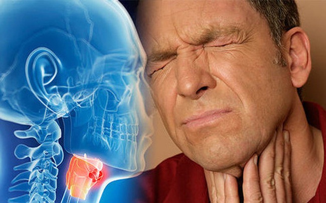 12 dấu hiệu quan trọng cảnh báo ung thư vòm họng: Chú ý lắng nghe cơ thể, phát hiện bệnh sớm 12 dấu hiệu quan trọng cảnh báo ung thư vòm họng: Chú ý lắng nghe cơ thể, phát hiện bệnh sớm