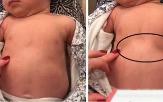 Bệnh viêm đường hô hấp vào mùa, BS lưu ý: Nếu trẻ có dấu hiệu này, phải đưa ngay vào viện Bệnh viêm đường hô hấp vào mùa, BS lưu ý: Nếu trẻ có dấu hiệu này, phải đưa ngay vào viện