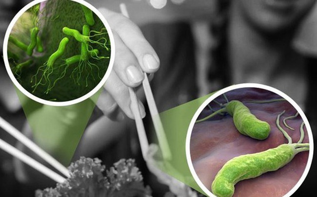 Loại vi khuẩn gây loét dạ dày từng được WHO xếp vào nhóm gây ung thư số 1: Có 3 biểu hiện để nhận biết ngay từ sớm Loại vi khuẩn gây loét dạ dày từng được WHO xếp vào nhóm gây ung thư số 1: Có 3 biểu hiện để nhận biết ngay từ sớm