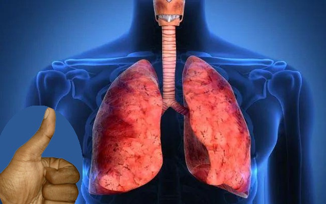 Người có phổi không khỏe có thể có 3 biểu hiện điển hình trên tay, làm 3 việc này sẽ giúp phổi khỏe mạnh Người có phổi không khỏe có thể có 3 biểu hiện điển hình trên tay, làm 3 việc này sẽ giúp phổi khỏe mạnh