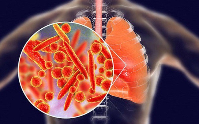 4 cách đơn giản giúp bạn nuôi dưỡng phổi khỏe mạnh, tránh xa bệnh tật trong mùa đông 4 cách đơn giản giúp bạn nuôi dưỡng phổi khỏe mạnh, tránh xa bệnh tật trong mùa đông