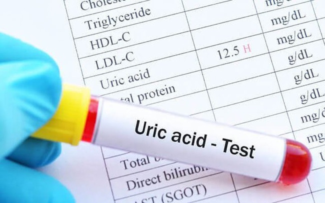 Người phụ nữ 28 tuổi bị suy thận, bác sĩ cho biết: Ngày nào cũng uống loại nước này là thủ phạm gây bệnh Người phụ nữ 28 tuổi bị suy thận, bác sĩ cho biết: Ngày nào cũng uống loại nước này là thủ phạm gây bệnh