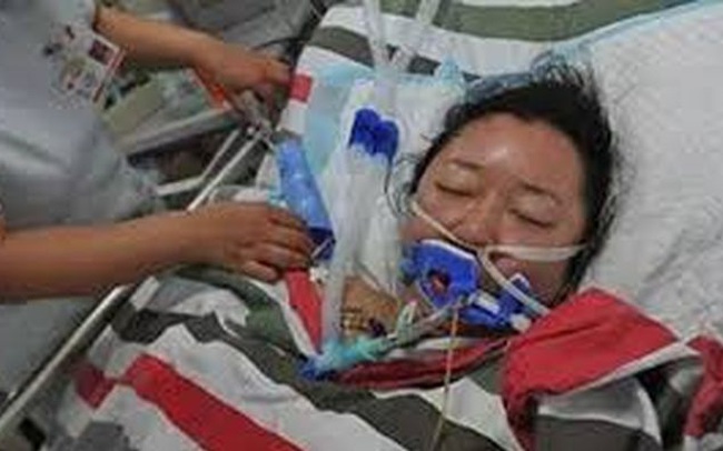 Người phụ nữ 2 lần ngất xỉu, bị chẩn đoán nhồi máu não vì thường xuyên ăn 2 món mà cũng có rất nhiều người mê Người phụ nữ 2 lần ngất xỉu, bị chẩn đoán nhồi máu não vì thường xuyên ăn 2 món mà cũng có rất nhiều người mê