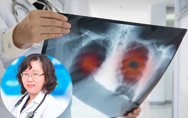 Cứ 10 người bị ung thư phổi, sau 5 năm chỉ 1-2 người còn sống: Bác sĩ chuyên khoa Hô hấp "điểm danh" những đối tượng nên tầm soát căn bệnh nguy hiểm này định kỳ