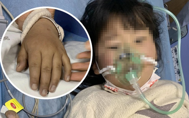 Bé gái 5 tuổi bị ngộ độc do ăn kim chi tự làm, cảnh báo bố mẹ những thực phẩm không nên cho trẻ ăn