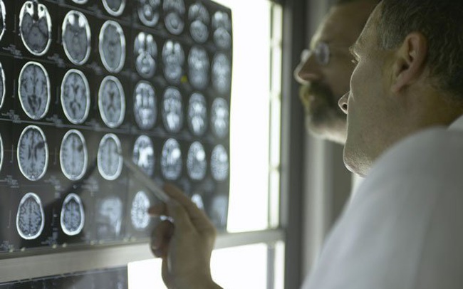 Tiến bộ vượt bậc: Các chuyên gia Mỹ phát minh ra "keo dán não", hứa hẹn bước tiến lớn trong giới y học