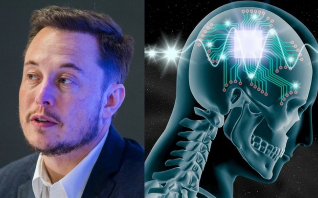Công ty của Elon Musk chuẩn bị cấy ghép chip vào não người để "chế tạo" siêu nhân