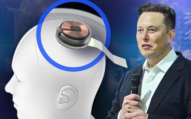 Elon Musk: ‘Công ty của tôi tự tin cấy chip vào não người trong 6 tháng tới’