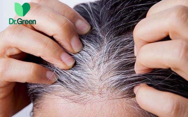 Bạc tóc sớm nguyên nhân và cách khắc phục