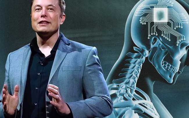 Elon Musk đã "copy" thành công não của chính mình
