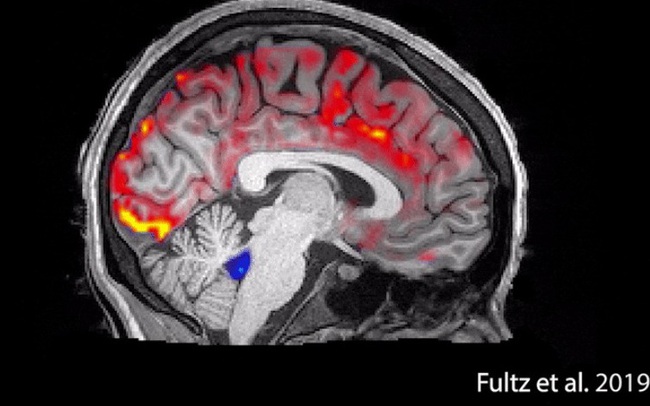 Điều gì xảy ra với não bộ khi bạn đang ngủ?