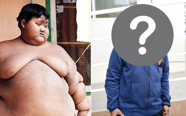 Từng nặng gần 200kg khi mới 10 tuổi, cậu bé “béo nhất thế giới” bây giờ ra sao sau hành trình giảm cân không tưởng?