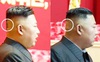 Băng dán đầu bí ẩn làm dấy lên những đồn đoán về sức khỏe ông Kim Jong Un