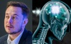 Công ty của Elon Musk chuẩn bị cấy ghép chip vào não người để 