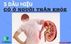 3 dấu hiệu chắc chắn có ở người thận khỏe: Đàn ông nếu thiếu 3/3 thì chức năng thận đã hư hỏng hết, đi khám ngay kẻo quá muộn