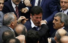 Khi các chính trị gia “thượng cẳng chân, hạ cẳng tay”