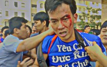 Lại tranh chấp đổ máu tại chung cư ở Sài Gòn