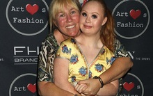 Câu chuyện đầy nghị lực của cô gái 19 tuổi mắc bệnh Down được trình diễn trên sàn catwalk của New York Fashion Week