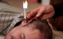 Không phải tăm bông, người ta còn có thể lấy ráy tai bằng nến