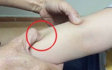 Lương y chỉ rõ 4 điểm chỉ cần ấn vào chữa bệnh ho không cần uống thuốc