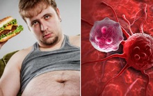 Tìm ra bằng chứng cho thấy ăn nhiều mỡ có thể thúc đẩy ung thư