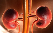 TS Mỹ chỉ rõ 5 bộ phận cơ thể tích tụ nhiều độc nhất: Nên ưu tiên thải độc để phòng bệnh