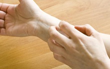 5 dấu hiệu bất thường trên da mà bạn cần nên đi khám ngay